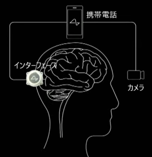ニューラリンク：ブラインドサイト：心眼